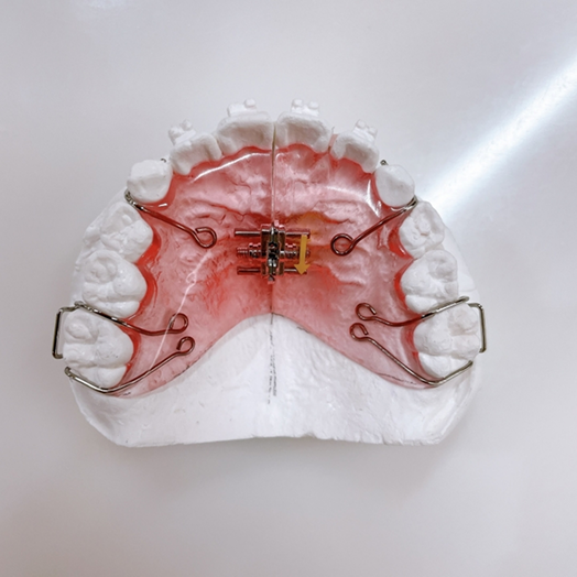 床（しょう）矯正治療​